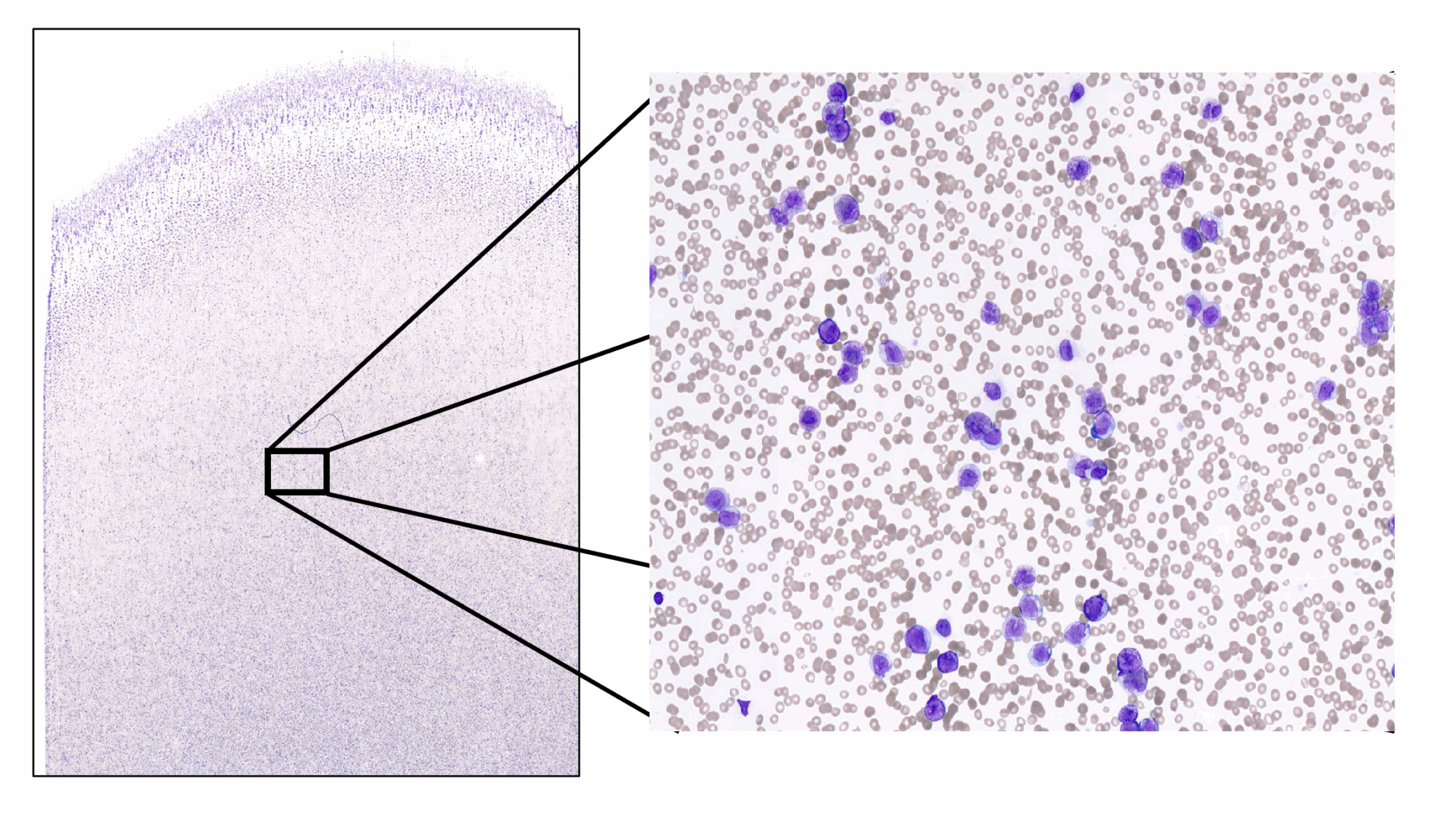 How the NHS and academia collaborate to speed up diagnosis for blood ...
